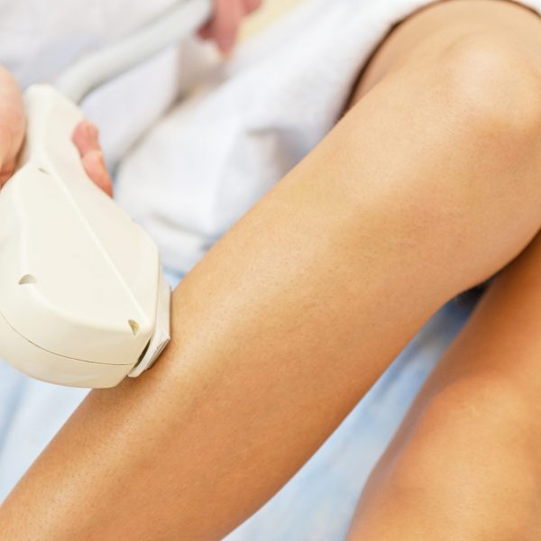 Laser hair removal on ladies legs