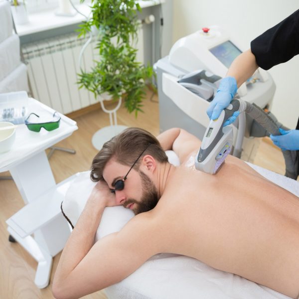 IPL therapy at men’s back Permanent hair removal at beautician's with laser therapy