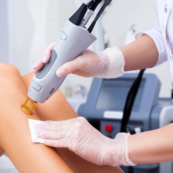 laser_hair_removal