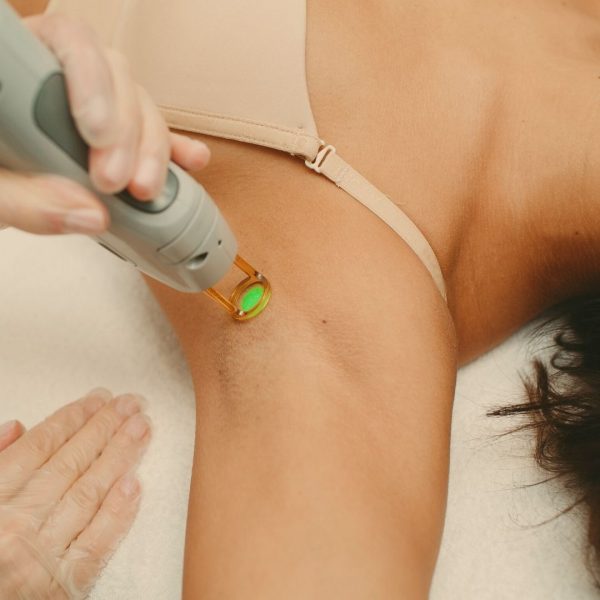 wedding hair removal wedding hair removal